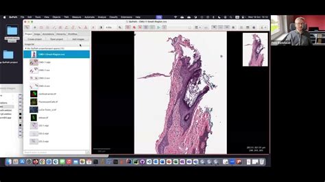 Image result for QuPath Basics