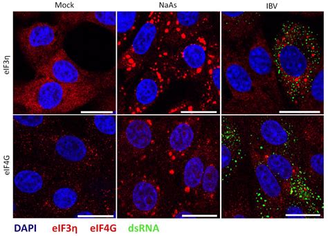 Infectious Bronchitis Virus Regulates Cellular Stress Granule Signaling