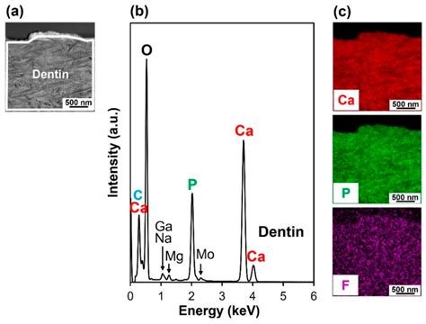 Fluoridated Apatite Coating on Human Dentin via Laser-Assisted Pseudo ...