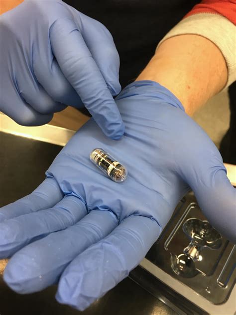 Image result for Colonoscopy Image System Component