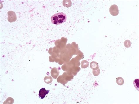 Autoagglutination - HORIBA