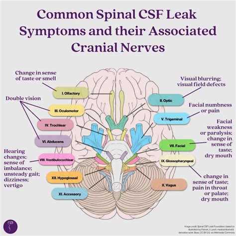 Csf Brain Leak Confidential Content Additions #914