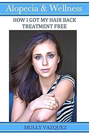 Buy Alopecia & Wellness: How I Got My Hair Back Treatment Free Book ...