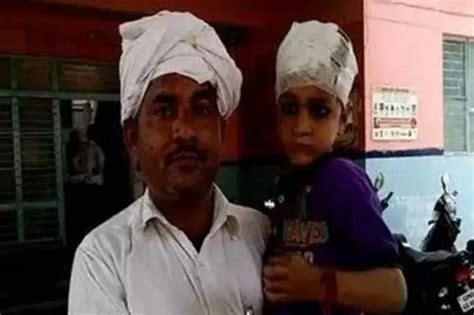 Another Shocking Case Of Medical Negligence, Doctors Leave Needle ...