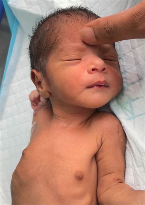 Newborn Reflex 的图像结果