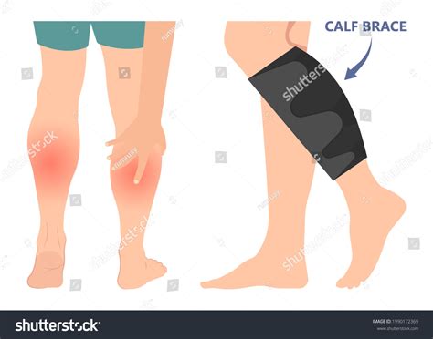 115 Calf Muscle Tear Images, Stock Photos & Vectors | Shutterstock