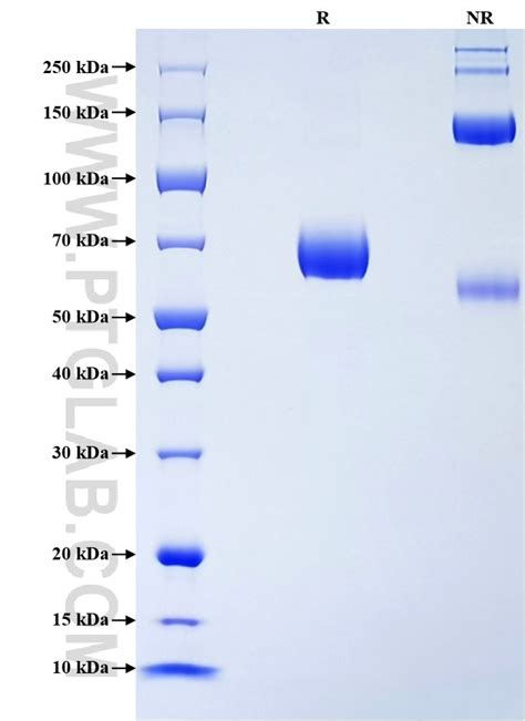 Recombinant Mouse CD38 protein (rFc Tag) | Proteintech