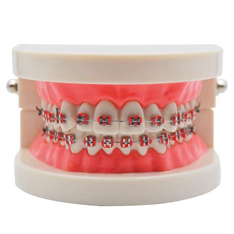 Buy Standard Tooth Teaching Mallocclusion Orthodontic Teeth Model with ...