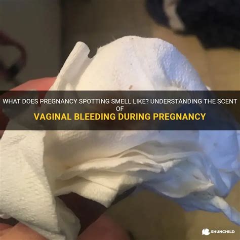 What Does Pregnancy Spotting Smell Like? Understanding The Scent Of ...