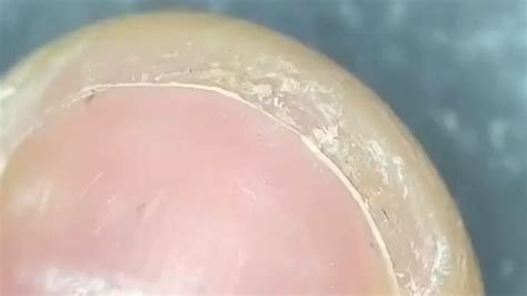 Image result for Finger Under Microscope