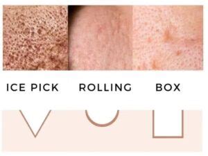 Eloura - Skin and Plastic Surgery Clinic in Bangalore