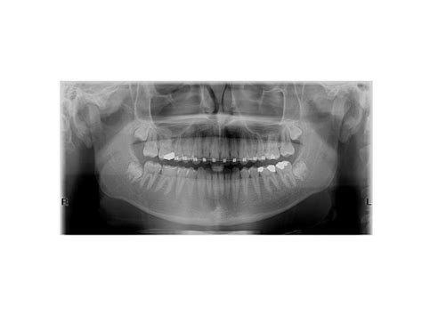 3DENT BEOGRAD | snimanje zuba, ortopan, 3d snimak vilice, cbct snimanje ...