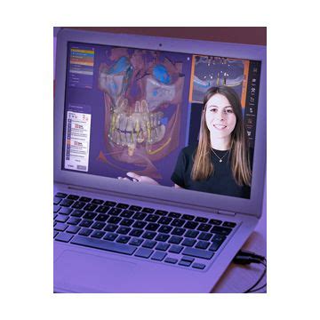 Exoplan Tutorial 的图像结果