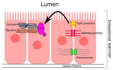 Obstructive Sleep Apnea as a Risk Factor for COVID-19 Severity—The Gut ...