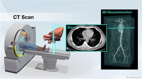 Image result for SPECT CT Scan Machine