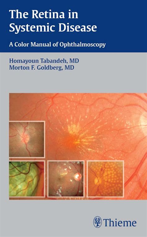 The Retina in Systemic Disease: A Color Manual of Ophthalmoscopy eBook ...