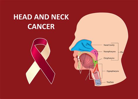 Neck Cancer Stages