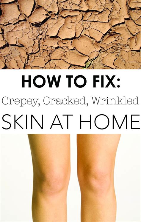 8 Images Home Remedy For Crepey Skin On Legs And Review - Alqu Blog