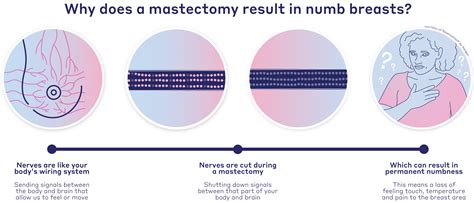 Restoring Sensation During Breast Reconstruction - BlackDoctor.org