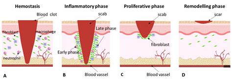 Wound Healing Primary Intention