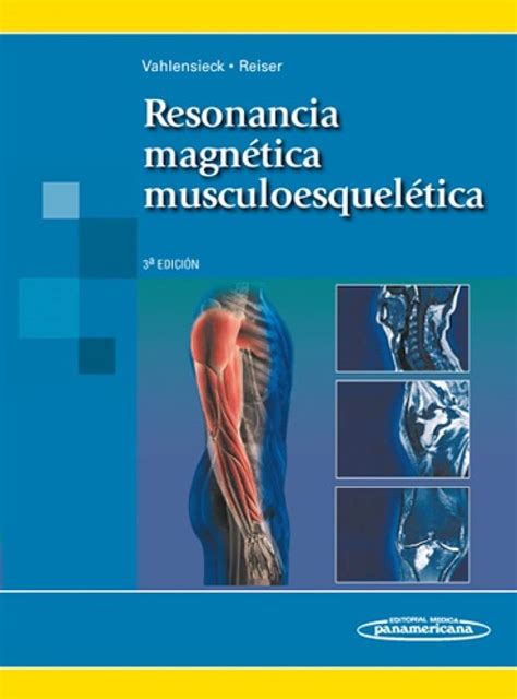 Buy Resonancia Magnetica Musculoesqueletica/ MRI of the Musculoskeletal ...