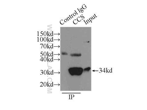 CCS antibody (22802-1-AP) | Proteintech