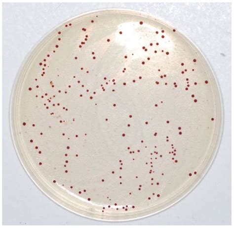 Two Screening Assays to Detect Vancomycin-Resistant Enterococcus spp.