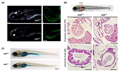Loss of Polycomb Repressive Complex 2 Function Alters Digestive Organ ...