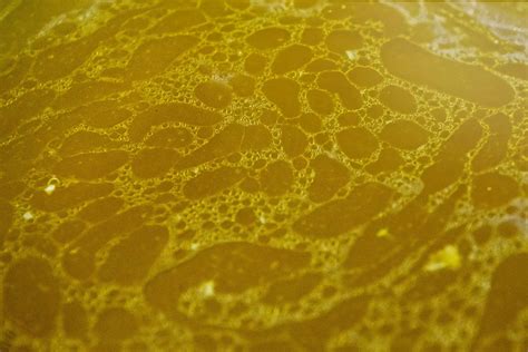 Oily Urine: What It Could Mean, According to an Expert Doctor