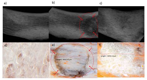 A 3D Bioprinted Pseudo-Bone Drug Delivery Scaffold for Bone Tissue ...