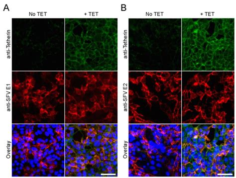 BST2/Tetherin Inhibition of Alphavirus Exit
