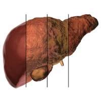 COVID 19 and NAFLD