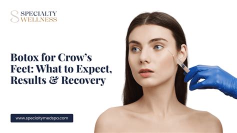 Botox for Crow’s Feet: What to Expect, Results & Recovery - Specialty Wellness