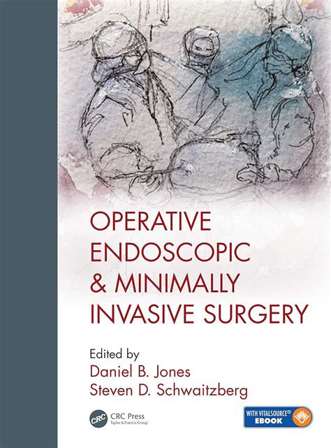 Operative Endoscopic and Minimally Invasive Surgery eBook : Jones ...