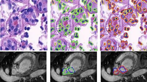 Medical Image Processing @ CVIT, IIIT Hyderabad