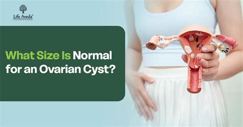 What Size Is Normal for an Ovarian Cyst? – Life Aveda
