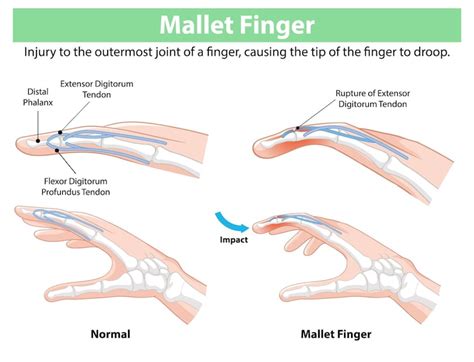 Leg finger Images - Free Download on Freepik