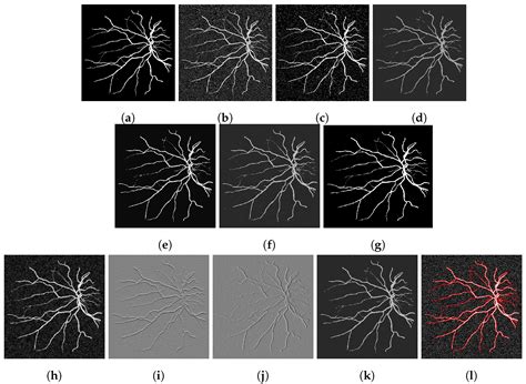 On a Variational and Convex Model of the Blake–Zisserman Type for ...
