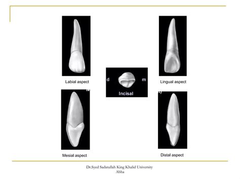 morphology of Maxillary central and lateral incisors teeth | PPT