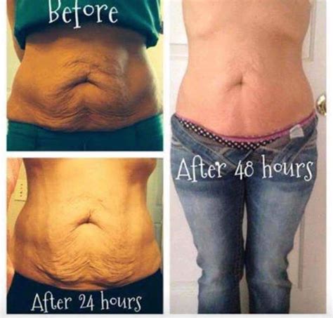 Pin by Olivera Stankovic on Quick Saves | Skin tightening stomach, Tighten stomach, Saggy skin