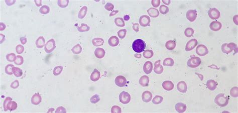 6 Probiotics Benefits for Physically Active People | FITPASS