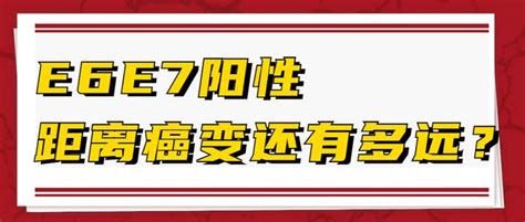 Open E7e File 的图像结果