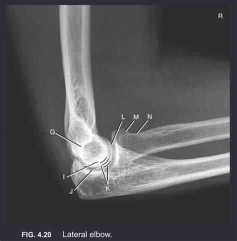 Image result for Elbow Contralateral