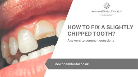 How To Fix A Slightly Chipped Tooth? – Newnham Dental