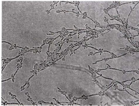 天然制剂中白色念珠菌真菌的显微观察照片-正版商用图片2gs6o5-摄图新视界