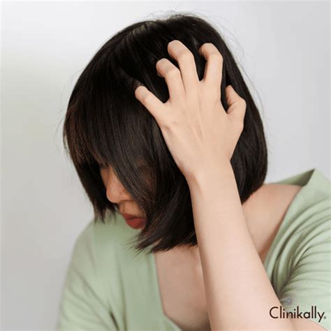 Itchy Scalp and Dandruff: Causes, Symptoms, and Treatment