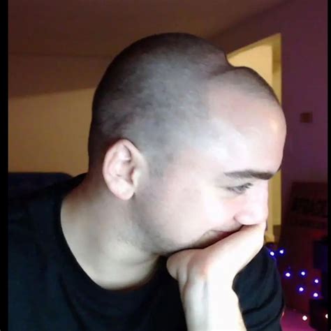 artifax | examples of dents in gamers heads also known as the 'headset ...