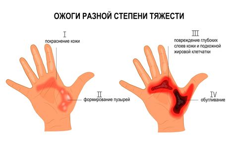 Как определить давность ожога