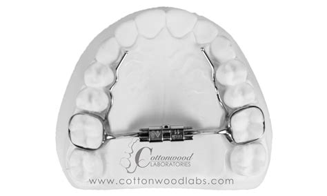 Image result for Mini RPE Expander