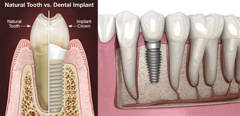 Care Dental Hospitals - Best Dental Hospital in Nellore | Dental ...